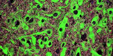 Alteraciones en un mecanismo del neurodesarrollo contribuiría al origen de trastornos mentales