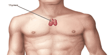 Se celebra hoy en Día mundial por la lucha contra la Miastenia gravis