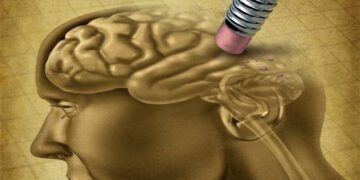 Alzheimer: Detectan un segundo caso de persona resistente a la enfermedad