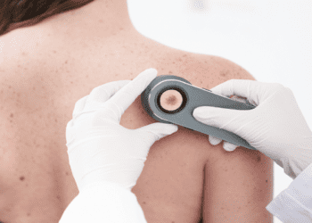 La Roche Posay lanzó la campaña “Salvá tu piel” 2023