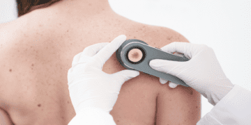 La Roche Posay lanzó la campaña “Salvá tu piel” 2023