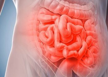 La importancia del diagnóstico precoz en el cáncer de colon