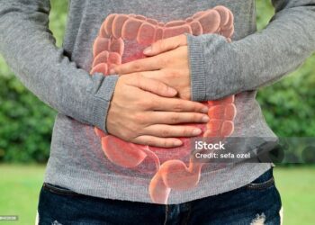 Un ensayo clínico revela un método natural y efectivo para recudir la recurrencia en el cáncer colorrectal