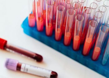 Las personas con este tipo de sangre tienen mayor riesgo de sufrir un derrame cerebral antes de los 60 años
