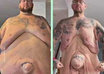 Perdió 154 Kg tras dejar de consumir sustancias ilícitas