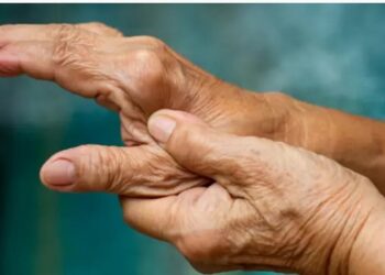 La artrosis de mano puede diagnosticarse de forma precoz para tratarse con éxito