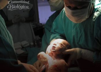Los partos por cesárea están impulsando una condición mortal