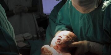 Los partos por cesárea están impulsando una condición mortal